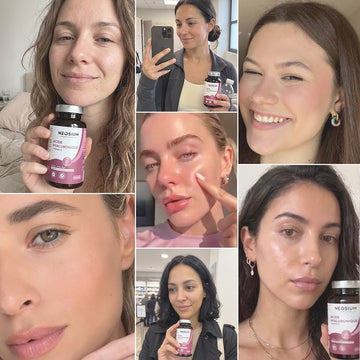 Mosaïque de 6 photos de clientes partageant leurs résultats et avis positifs après leur cure d'acide hyaluronique Neosium